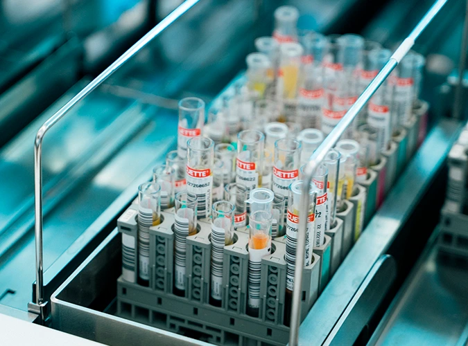 Descrição: Material de laboratório, tubos de ensaio. Créditos: © Fundação ”la Caixa”
